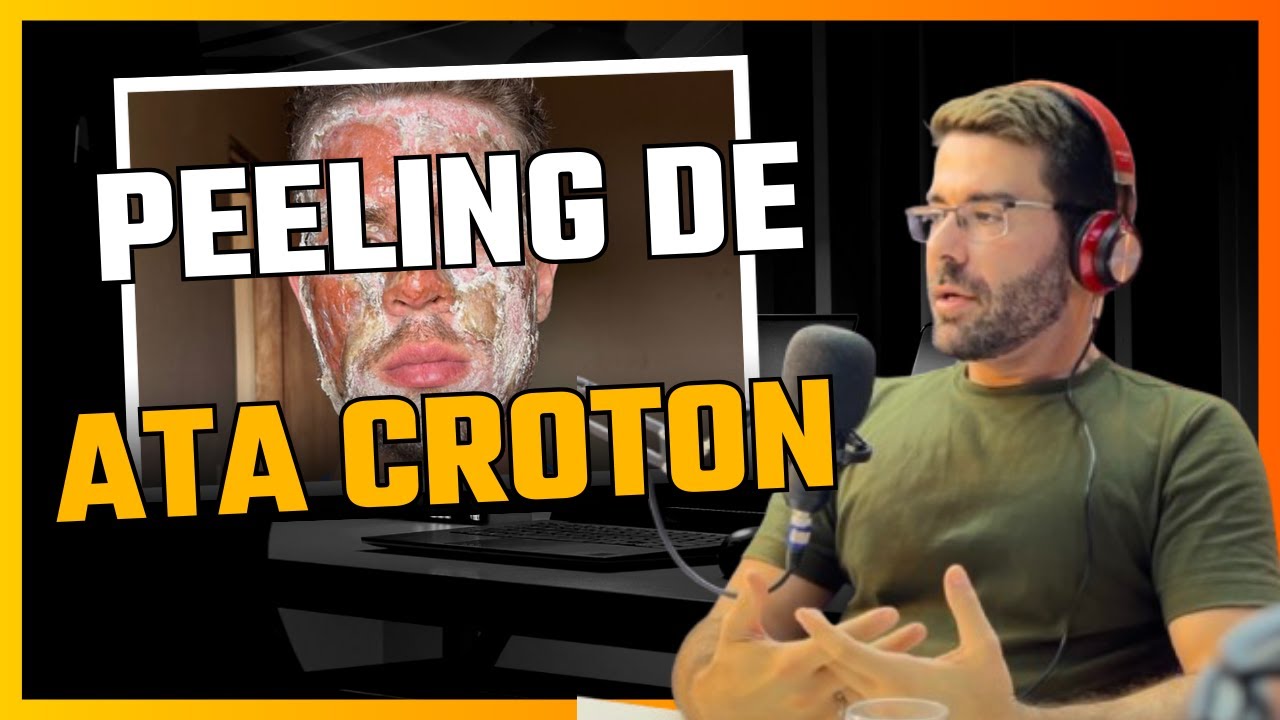ATA CROTON - Tudo sobre Peeling de Ata Croton / PEELING PROFUNDO / Peeling de Fenol / ATA Gold