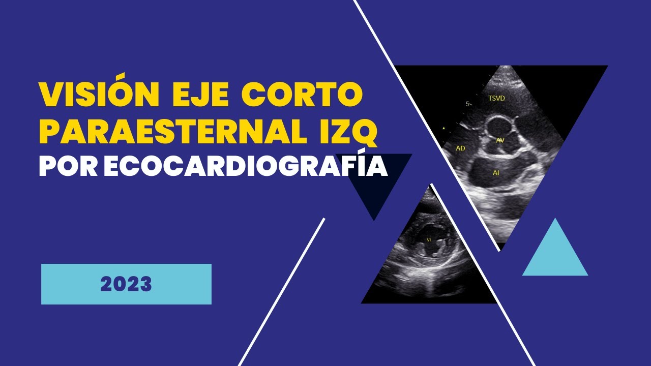 🔎[Vision] 🔪EJE CORTO PARAESTERNAL IZQUIERDO [por Ecocardiografía]