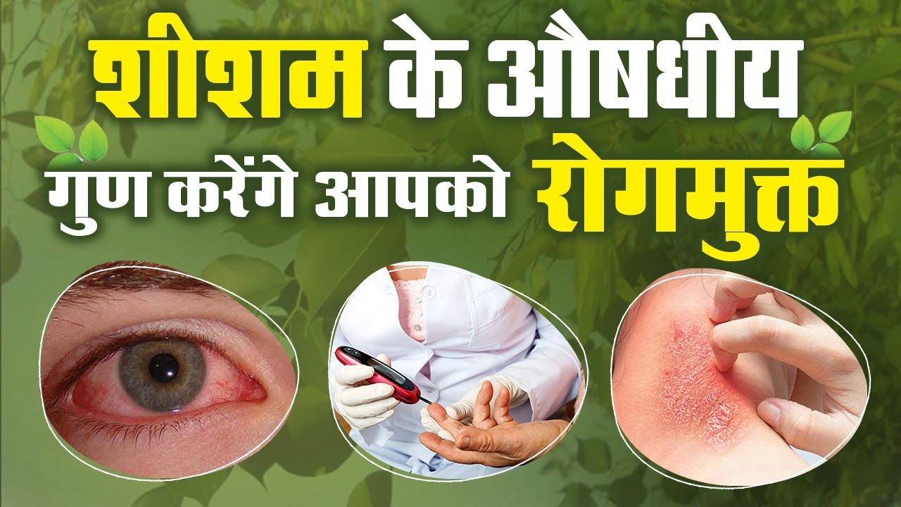 शीशम के पत्ते खाने के अद्भुत और चमत्कारी फायदे I Medicinal Benefits of Sheesham I Health Darshan