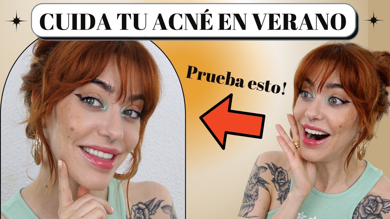 ✅Cómo cuidar tu PIEL GRASA con ACNÉ en verano ➡️ [7 productos RECOMENDADOS!]