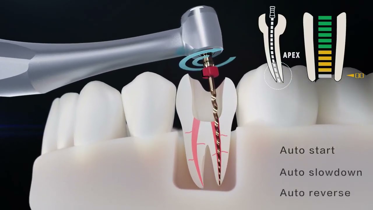 Woodpecker Endo radar pro