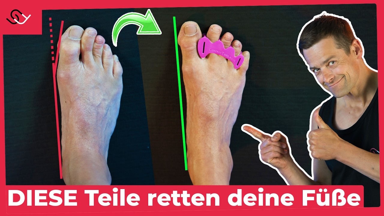Hallux Valgus - Der einfachste Weg ihn loszuwerden!