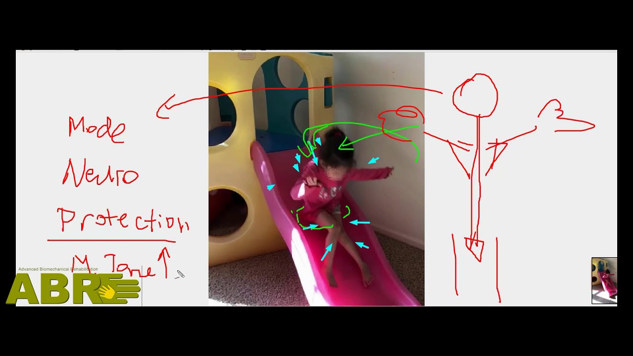 Lessons on Cerebral Palsy. Creative Movements vs Ballistic Motion. By Leonid Blyum