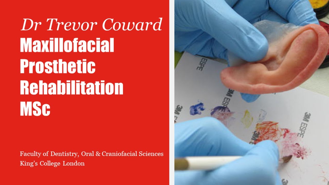 Maxillofacial Prosthetic Rehabilitation MSc overview | King's College London