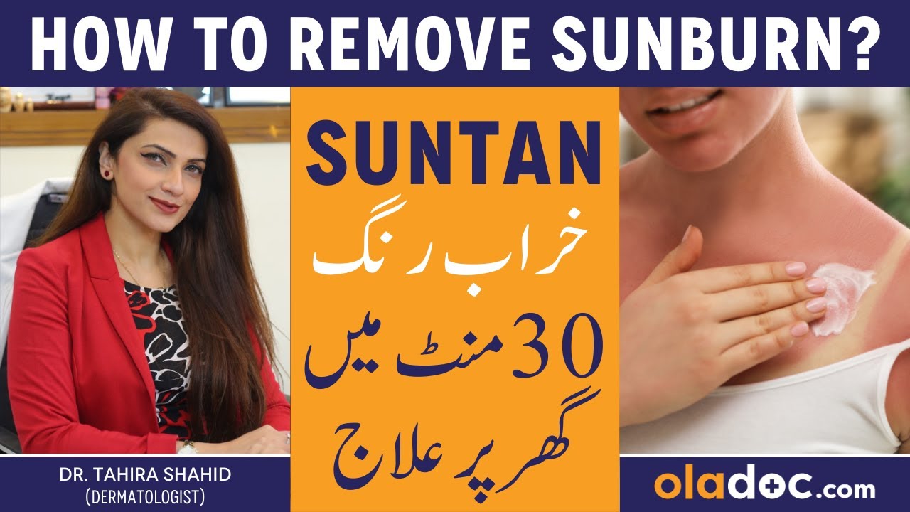 SUNBURN SKIN KO KAISE THIK KARE - Dhoop Se Rang Kala Ho Jaye To Kya Karen - Suntan Treatment At Home