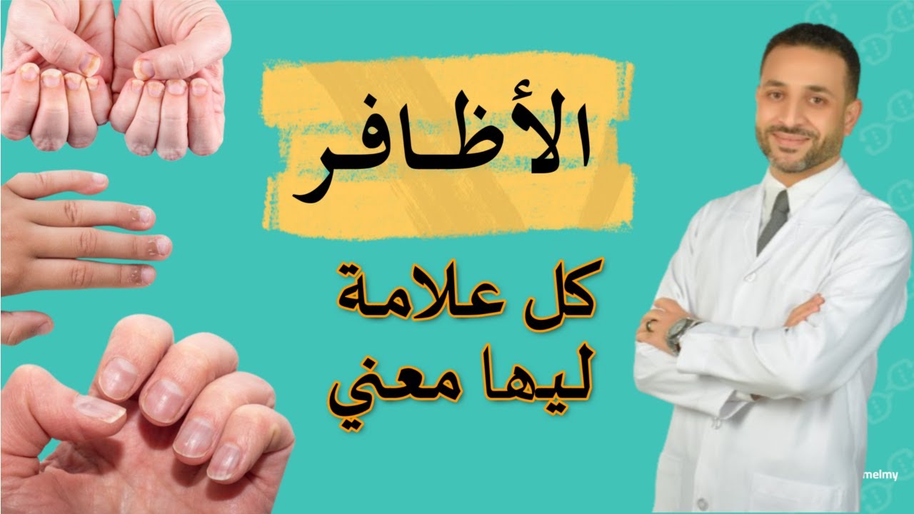شكل الأظافر وعلاقتها بالامراض | أهم الفيتامينات والاطعمة للاظافر والشعر| 12 علامة لاتهملها في أظافرك