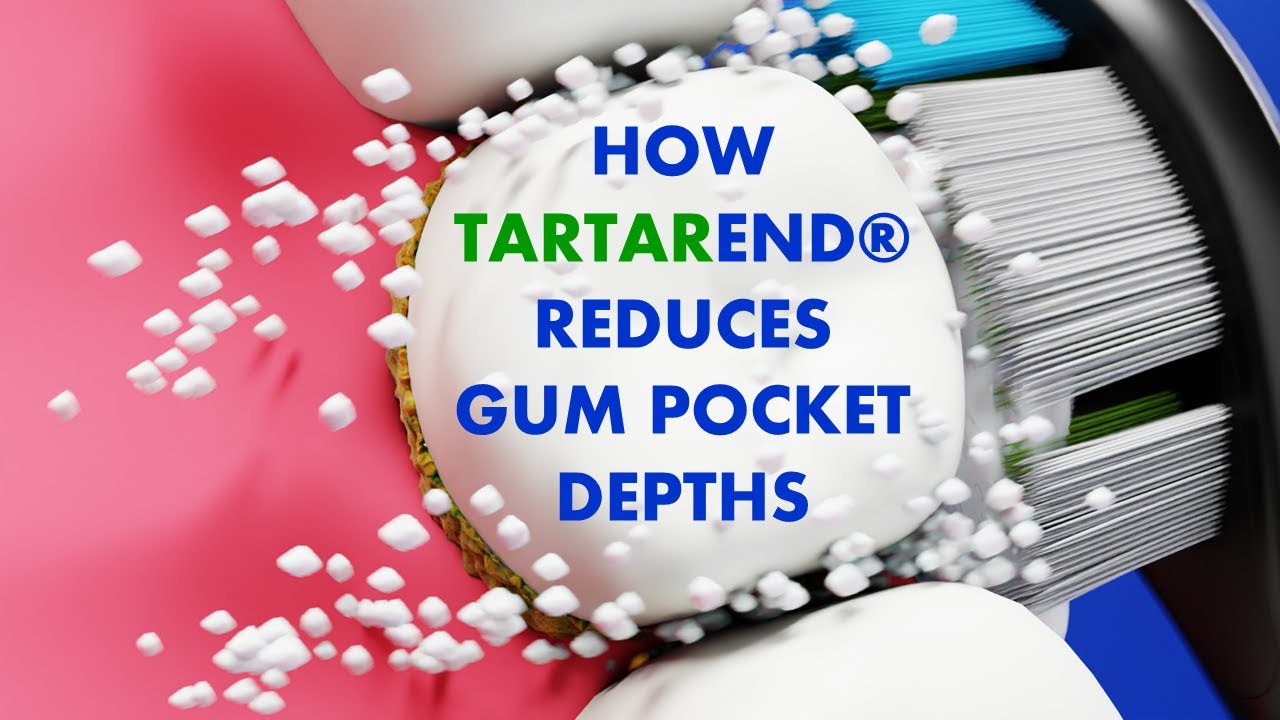 How Tartar End Reduces Gum Pocket Depths