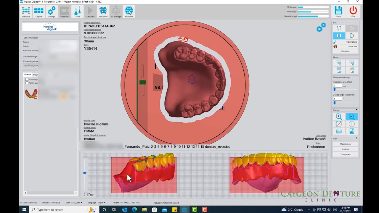 Nesting CUD-CLD for Milling on Ivoclar's PM7