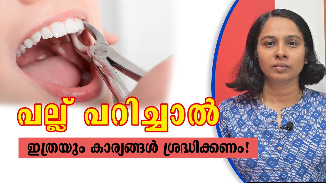 പല്ല് പറിച്ചാൽ ശ്രദ്ധിക്കേണ്ട  കാര്യങ്ങൾ | Tooth Extraction | Dr Juby Jose | Aayushcare