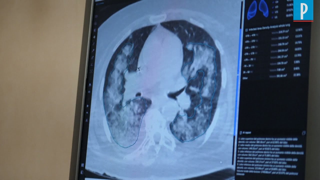 Un scanner pour détecter le coronavirus chez des personnes au « test négatif »