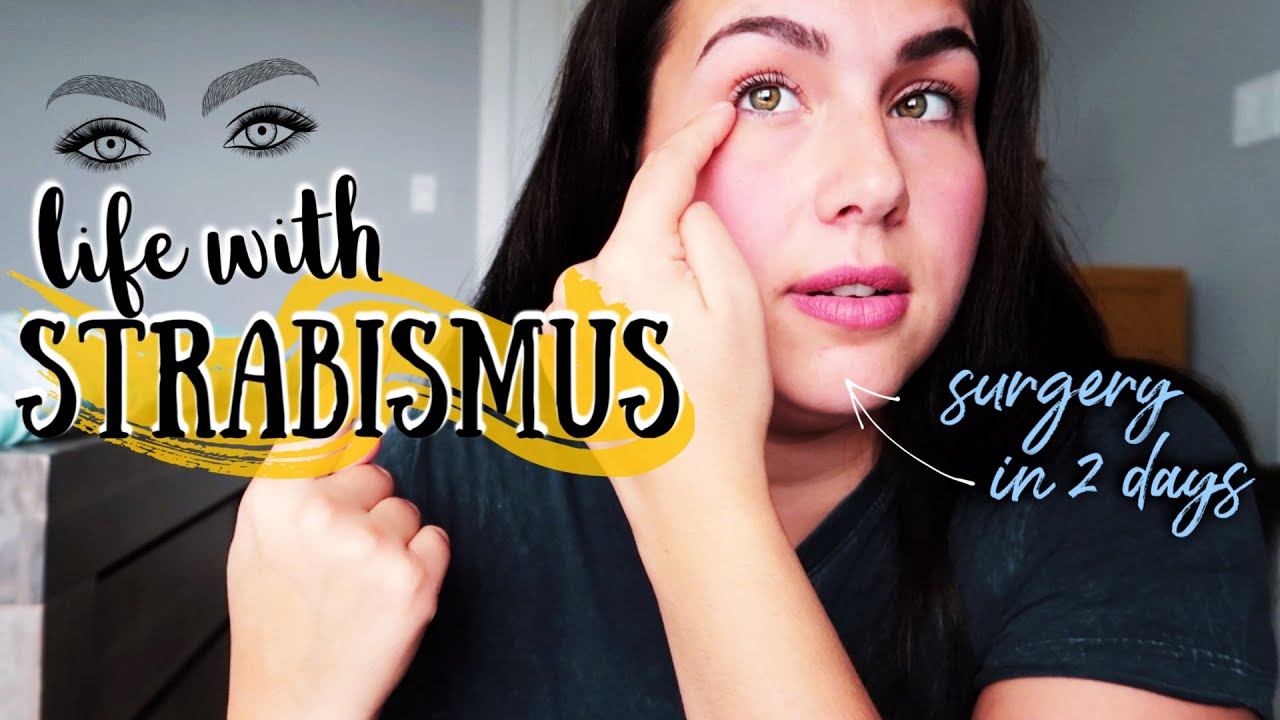 WHAT IS STRABISMUS? | What To Expect for Surgery | Getting lazy eye surgery 2019 | Strabismus Story!