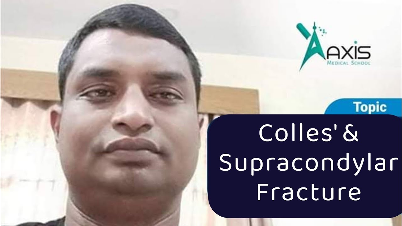 Colles' & Supracondylar Fracture