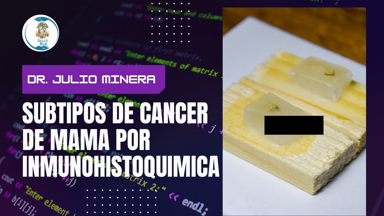 Seminario 394. Subtipos de cáncer de mama por inmunohistoquímica.  Dr. Julio Minera