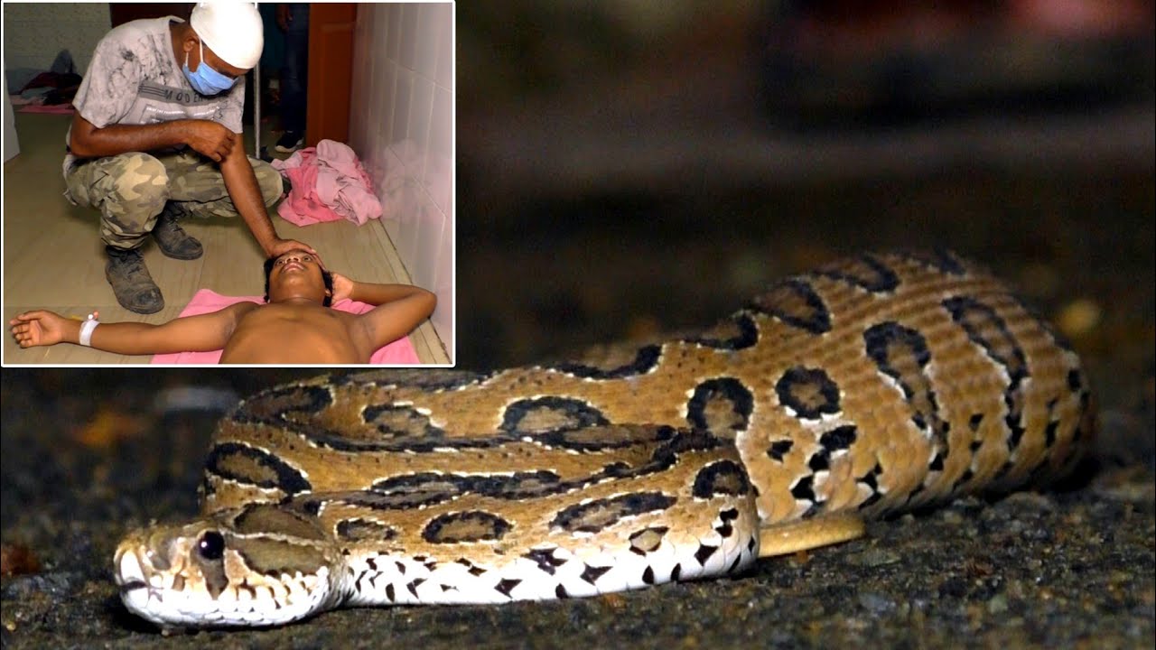 चंदन बोड़ा सर्प के काटने के बाद कैसे बची बच्चे की जान।Teenager saved after bitten by Russel viper.