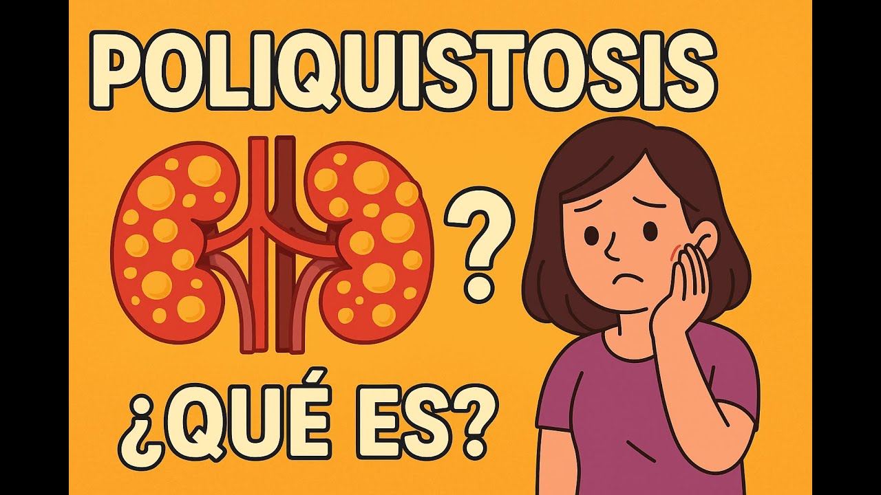 Poliquistosis Renal Autosómica Dominante: Qué es, cómo se hereda y cómo se desarrollan los quistes.