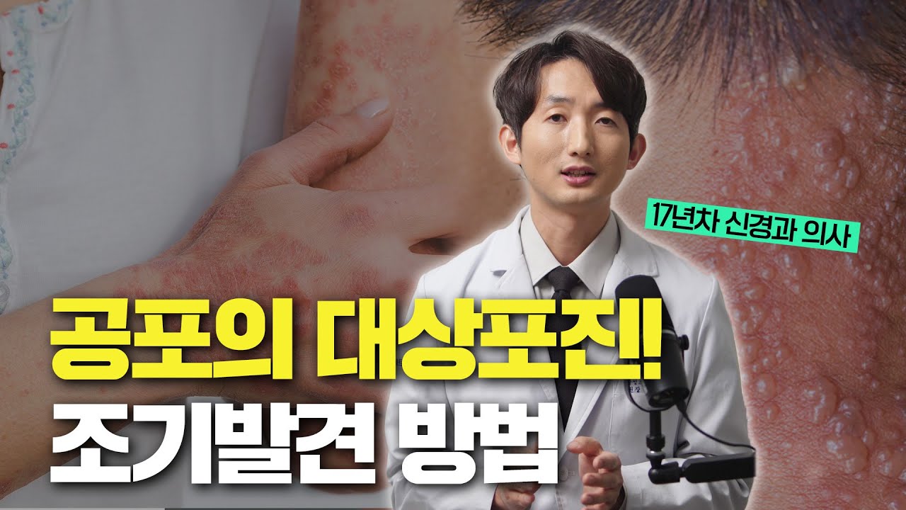 대상포진 초기증상, 발진 전에도 알 수 있습니다! | 신경과 전문의