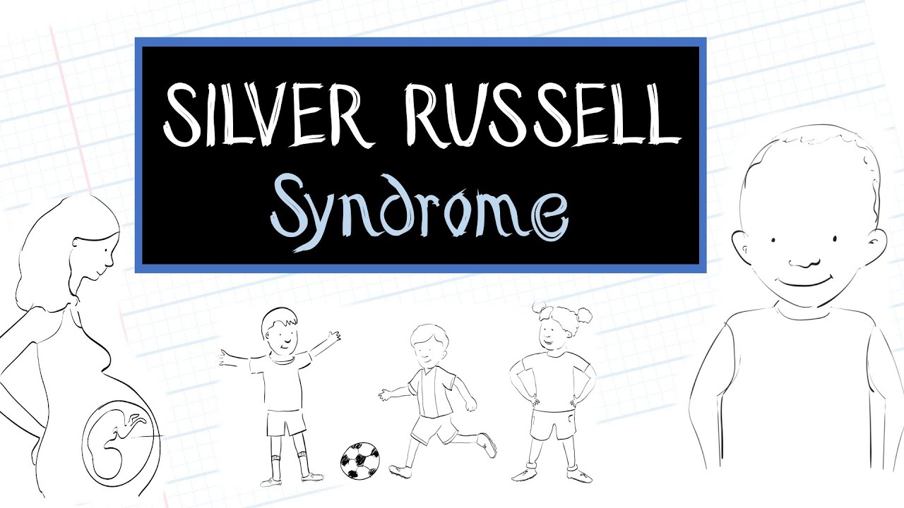 What is Silver-Russell Syndrome (SRS)?