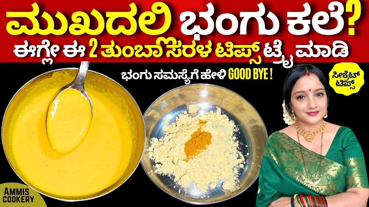 ಅಯ್ಯೋ ಮುಖದಲ್ಲಿ ಭಂಗು? 100% ಚಿಂತೆ ಬಿಡಿ ಇಷ್ಟು ಮಾಡಿ ಸಾಕು Ammis Cookery Beauty Tips -6/100 |Bhangu remedy