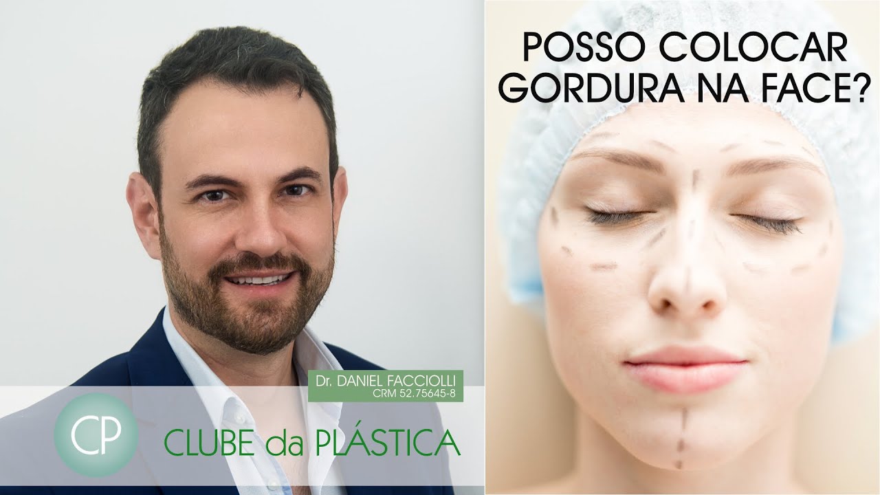 Clube da Plástica: Posso colocar gordura na face?