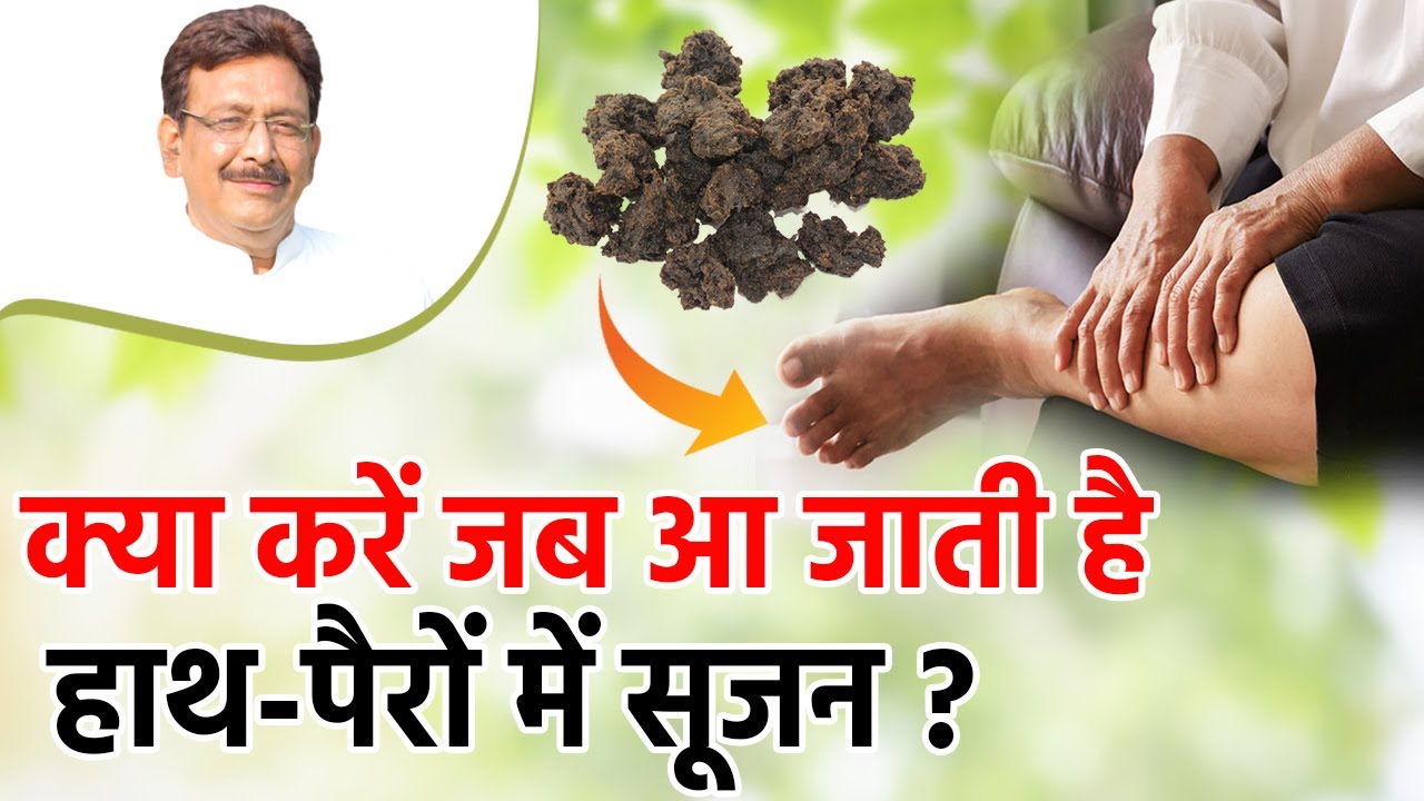 हाथ-पैर में सूजन की समस्या में करें ये घरेलू उपाय!