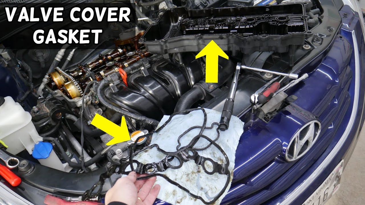 HYUNDAI SONATA VALVE COVER GASKET REPLACEMENT REMOVAL, VALVE COVER GASKET LEAKING OIL