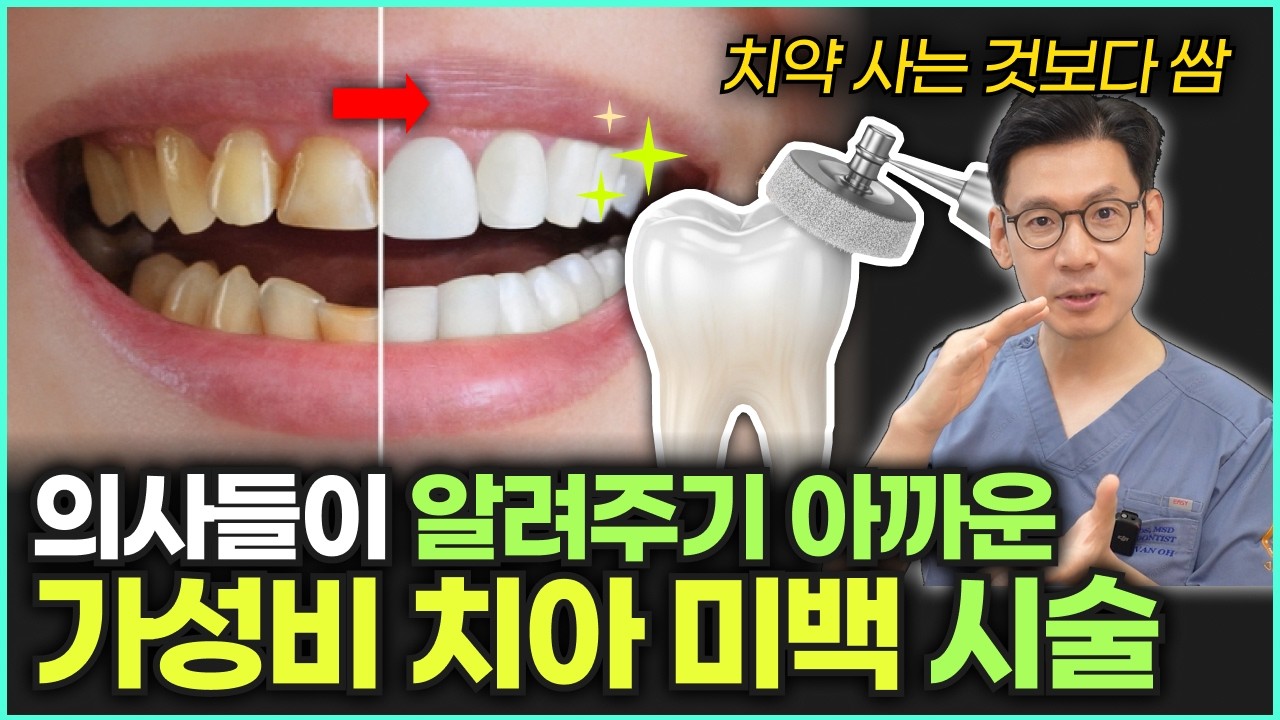치아미백, 돈 쓰지 마세요. 치아를 하얗게 만드는 5가지 쉬운 방법!