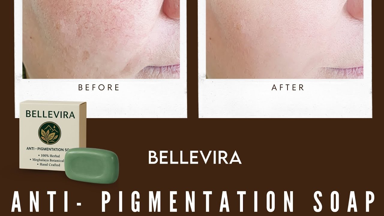 Anti- Pigmentation Soap | Chemical Free | Bellevira Naturals 