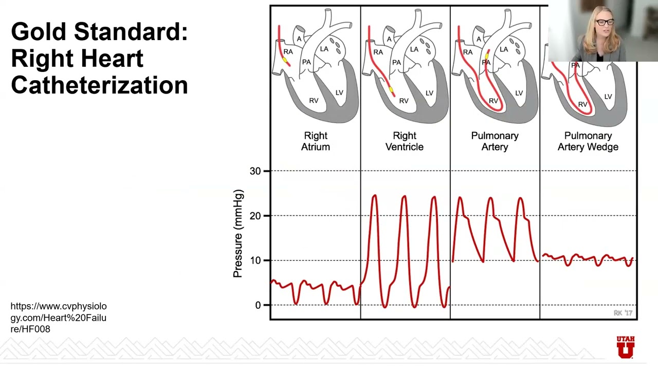Updates in Pulmonary Hypertension