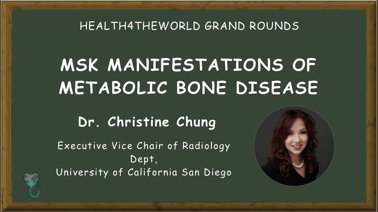 MSK Manifestations of Metabolic Bone Disease