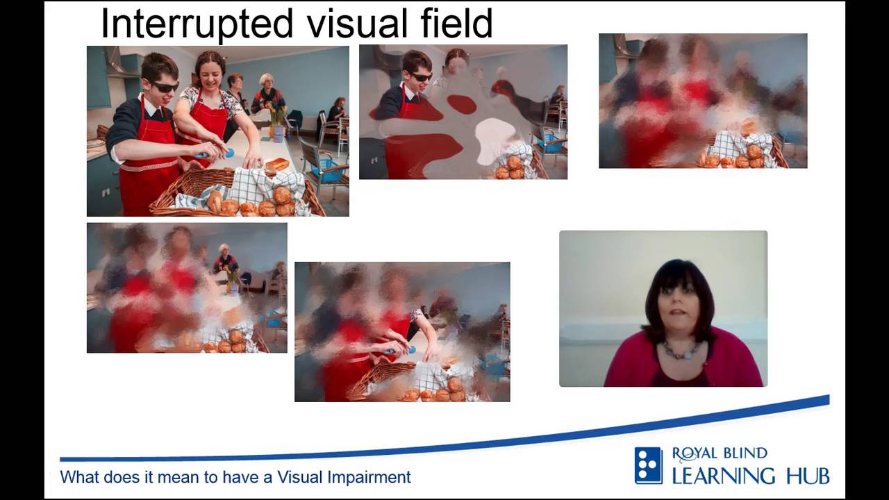 What does it mean to have a Visual Impairment?