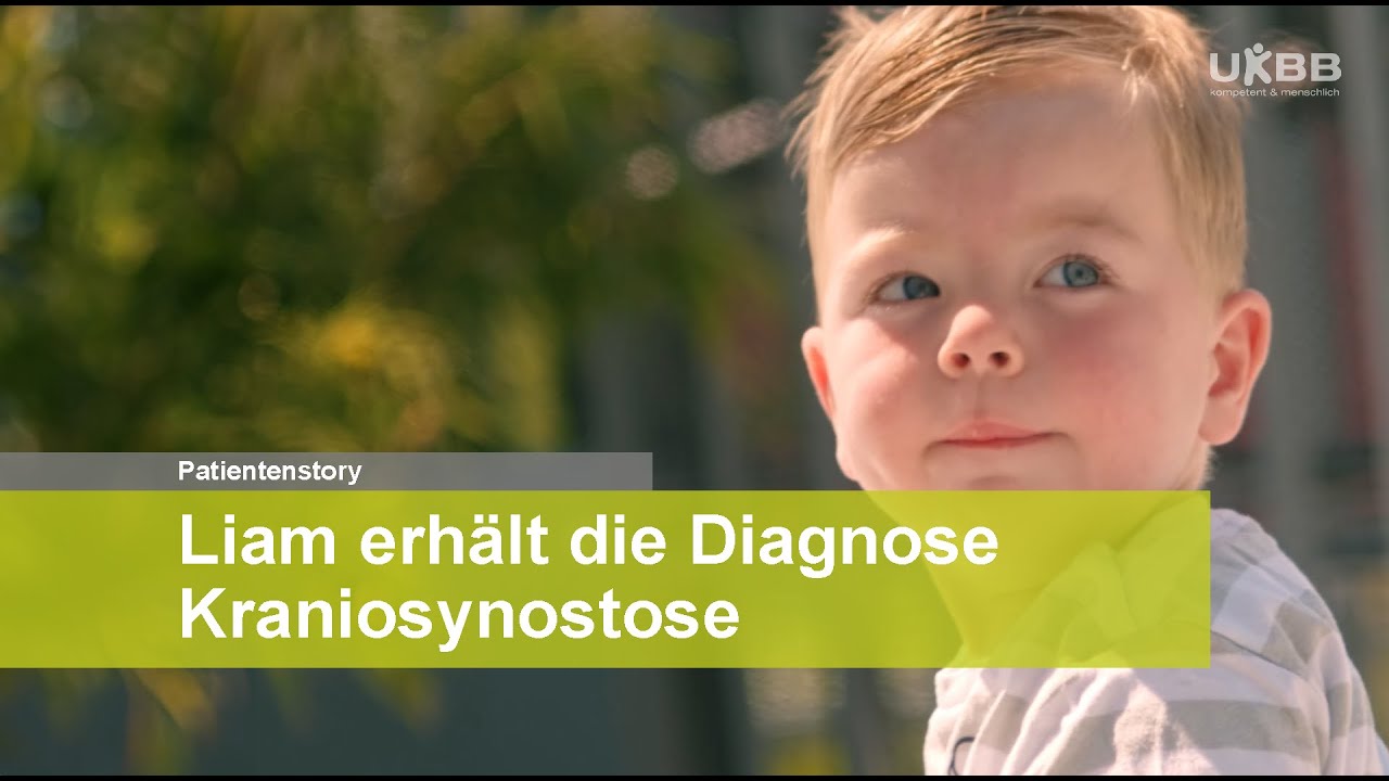 Der kleine Liam und seine Diagnose «Kraniosynostose»