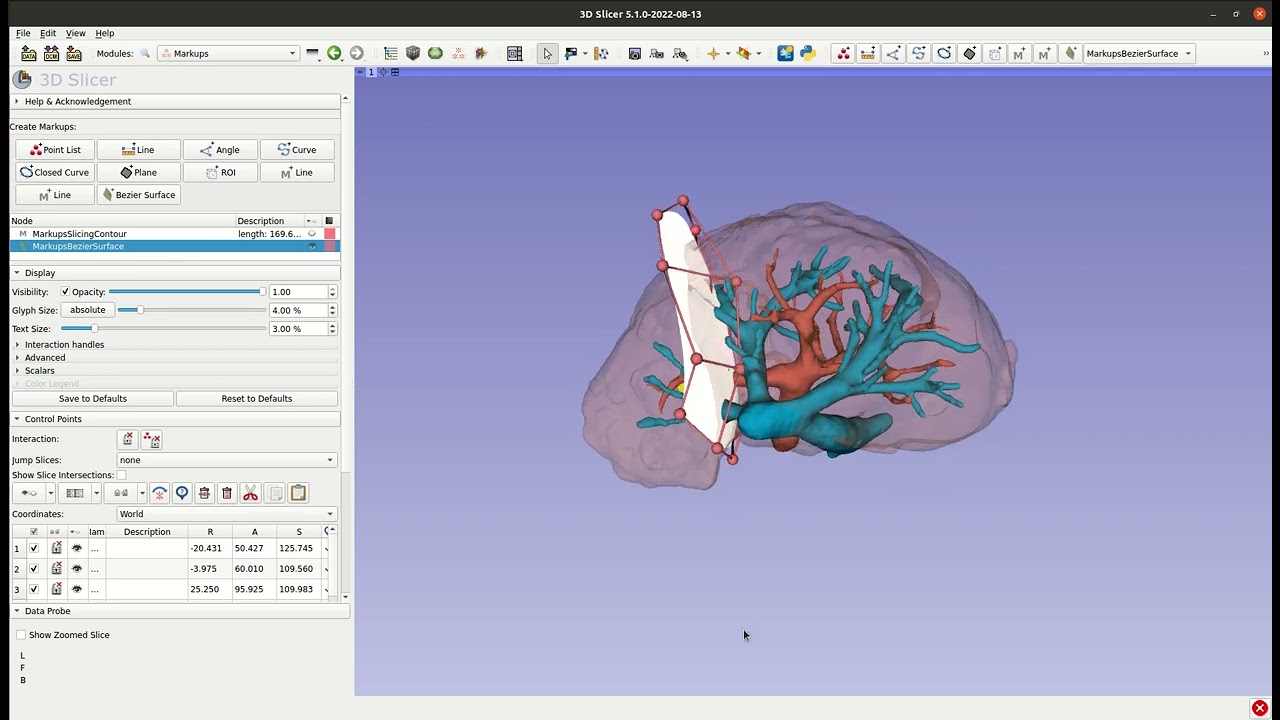 Slicer-liver tutorial