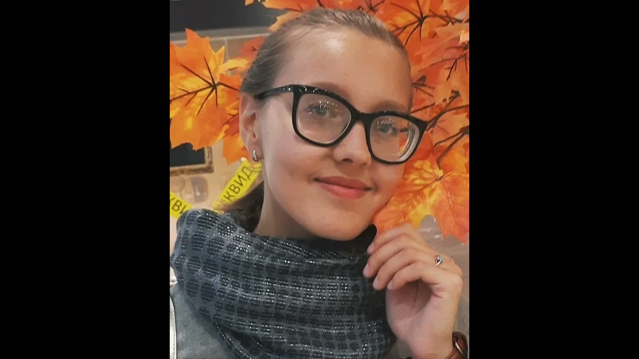 ❤️High myopia girls with Glasses ❤️ #glasses #hyperopia #myopia #strongglasses #thickglasses