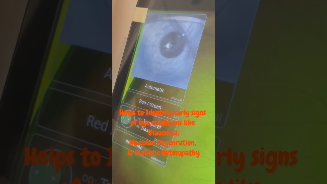 OPTOS : Retina examination without pupil dilation #retinacare #eyecare #suneyecafe
