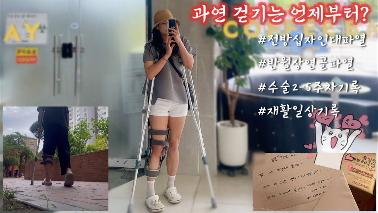 전방십자인대 파열 후 재건수술, 십자인대 수술 후 2-5주차 재활운동 십자인대재활운동 재활브이로그