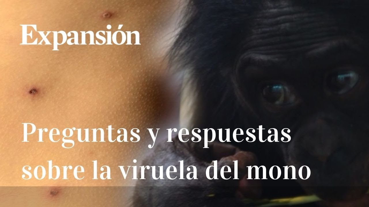 C&oacute;mo se contagia y cu&aacute;les son los s&iacute;ntomas de la viruela del mono