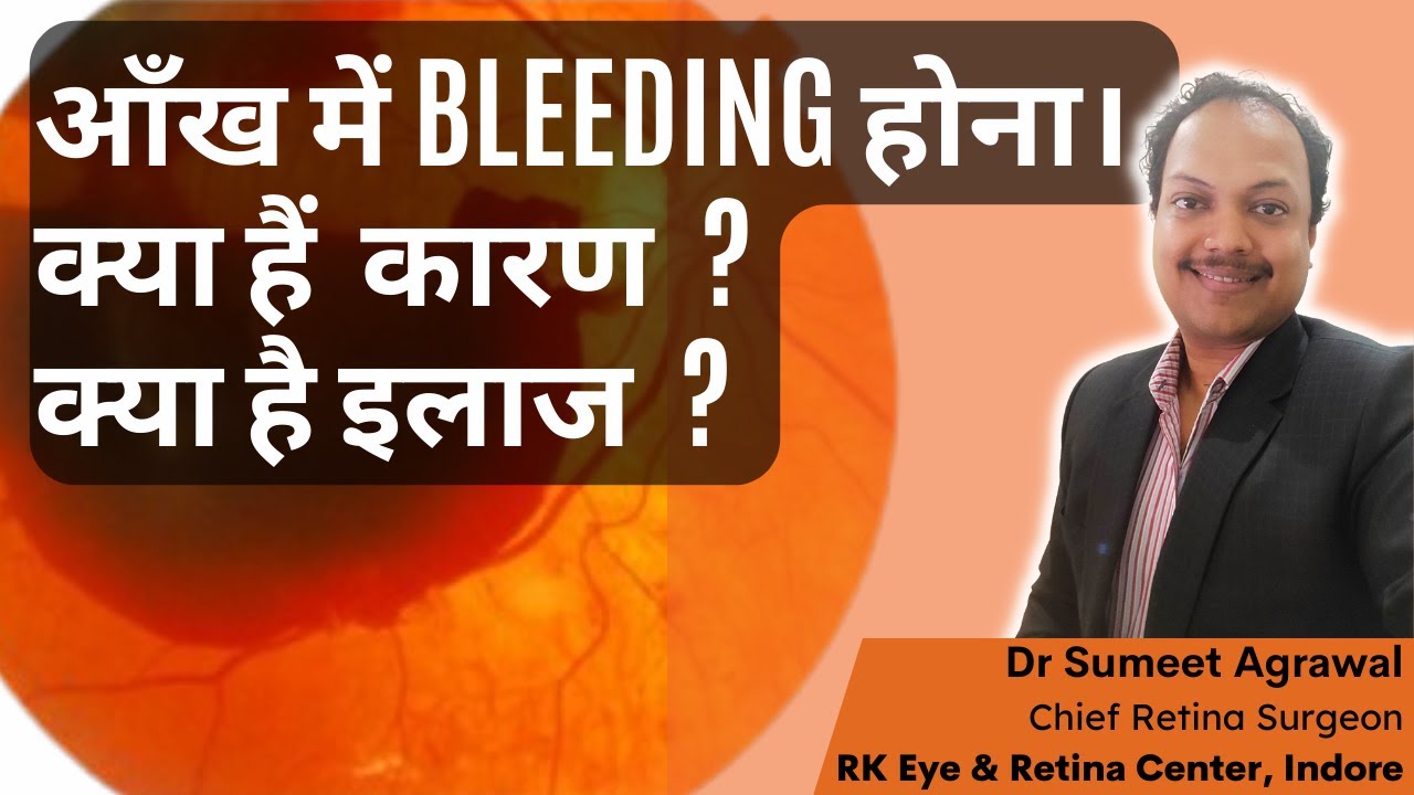 आँख में BLEEDING होना ! जानिये कारण और इलाज l