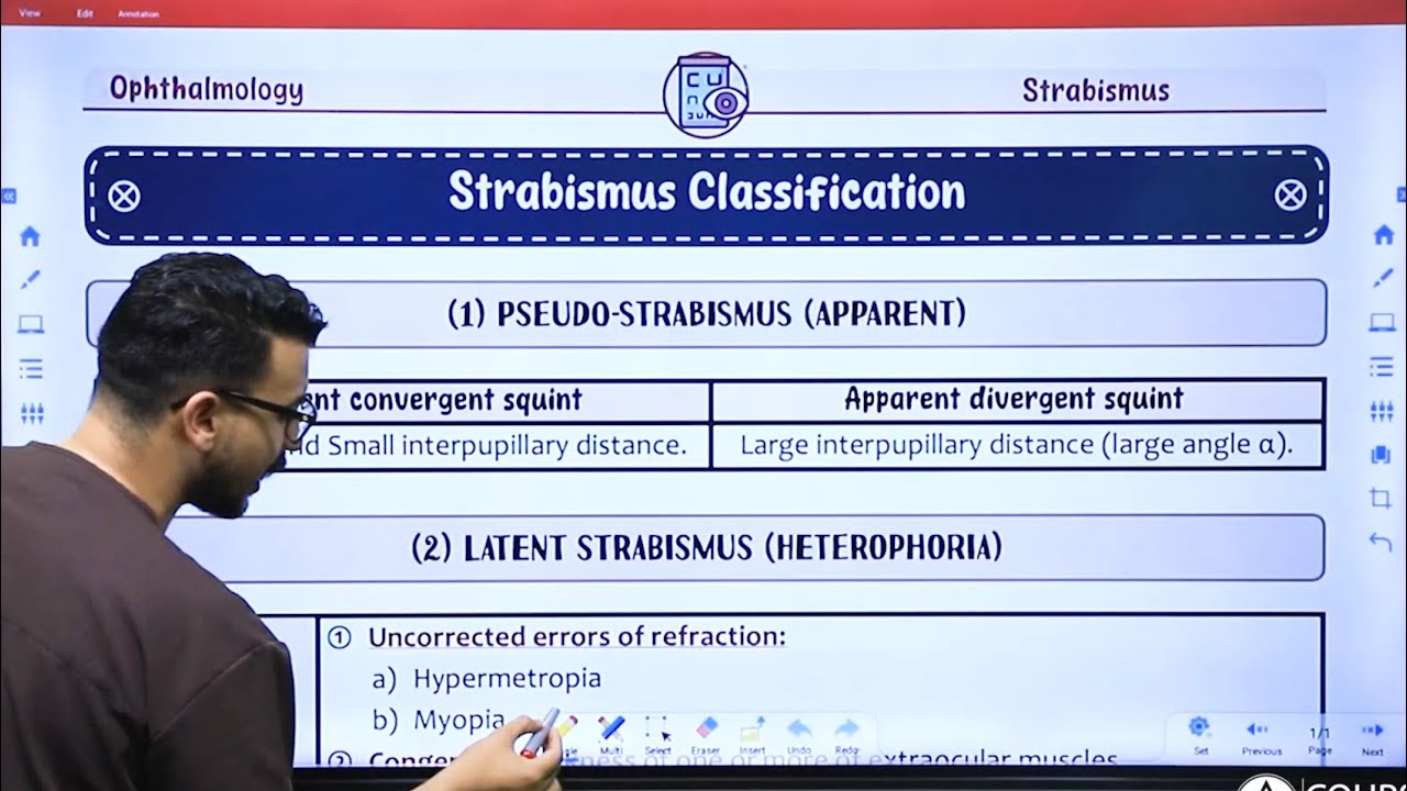 Horus - Types of Strabismus Extra