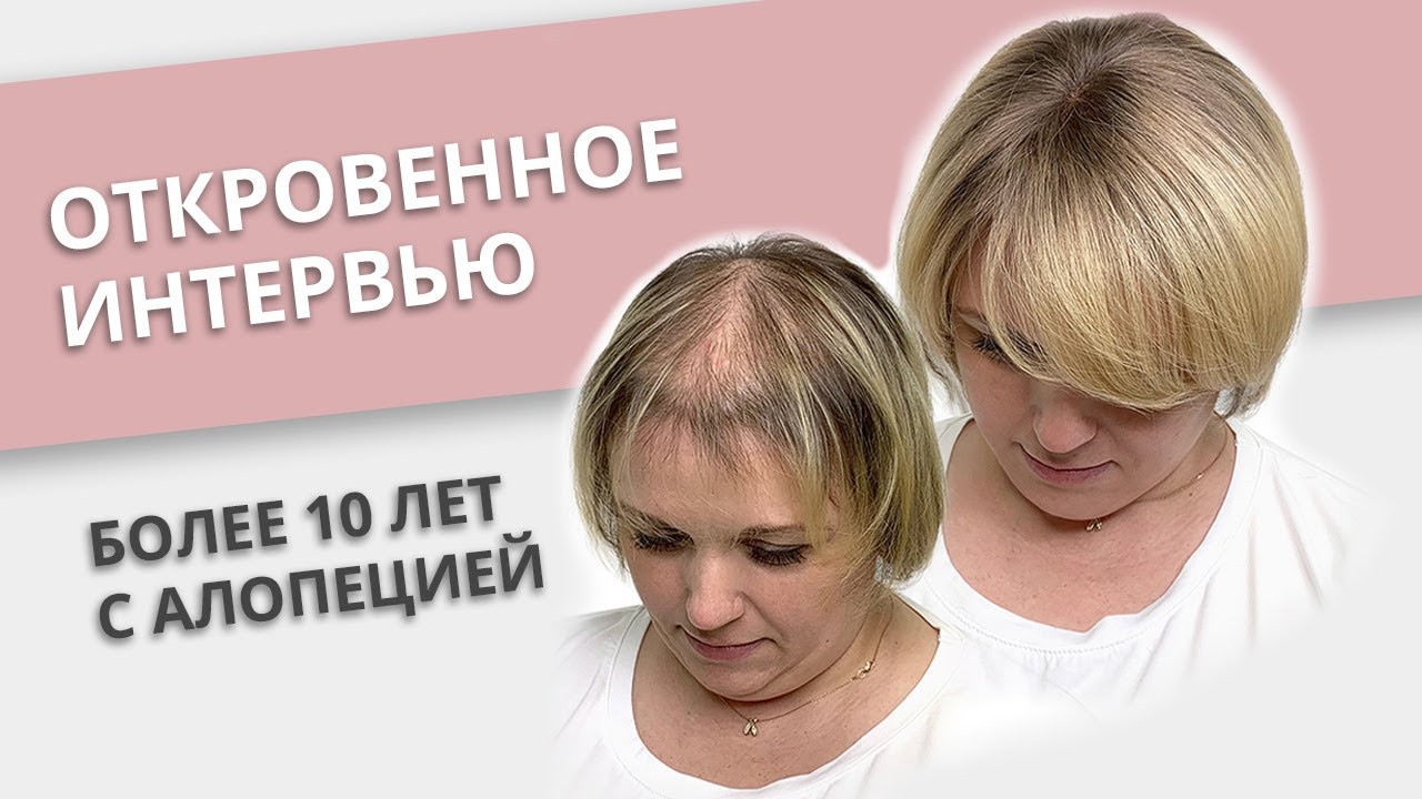 Парик или система что лучше?