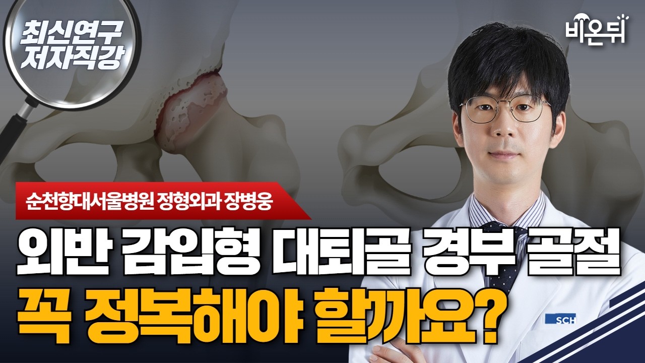 [최신연구 저자직강] 외반 감입형 대퇴골 경부 골절, 꼭 정복해야 할까요? / 순천향대서울병원 정형외과 장병웅