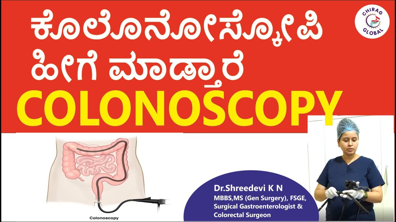 ಕೊಲೊನೋಸ್ಕೋಪಿ ಹೀಗೆ ಮಾಡ್ತಾರೆ |📞8867546900 | Dr. Shreedevi K N | Chirag Global Hospitals #colonoscopy