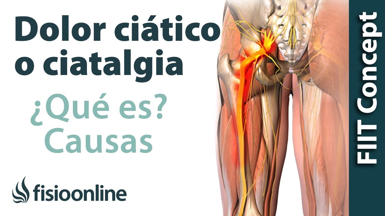 ¿Qué es la ciática o ciatalgia y cuáles son sus causas?