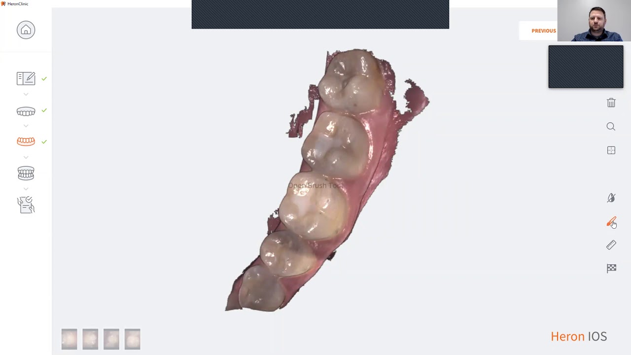 HeronIOS 
