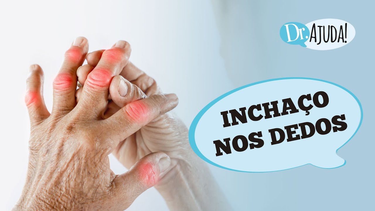 INCHA&Ccedil;O NOS DEDOS: O QUE PODE SER? O QUE FAZER?