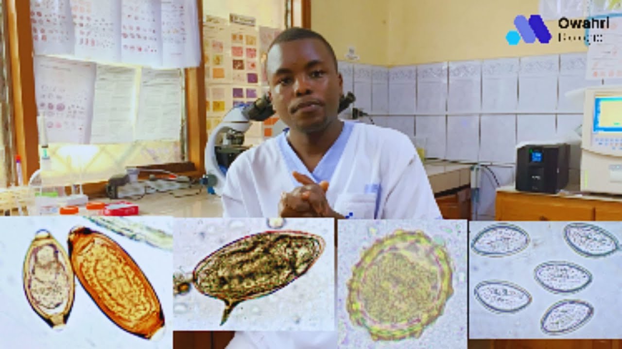 Comment faire un examen parasitologique des selles ? #coprologie 1