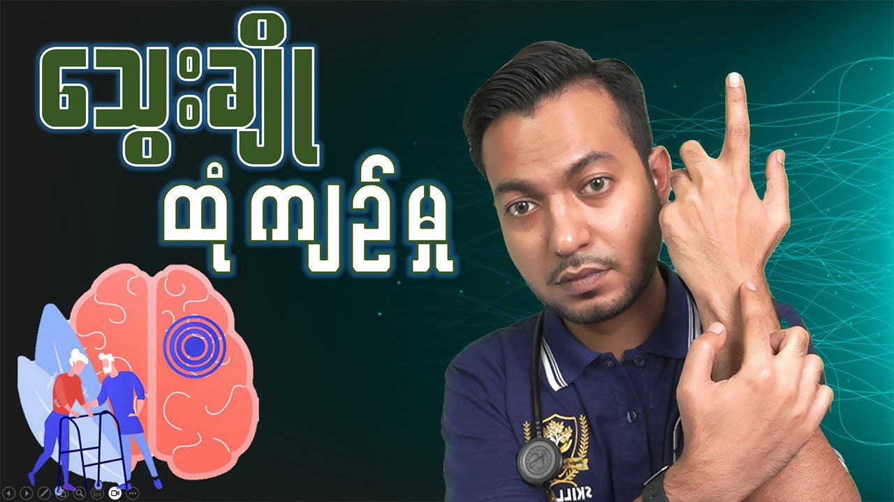 သွေးချို ထုံကျဉ်ရောဂါ | Diabetic Neuropathy | by Dr. Zwe