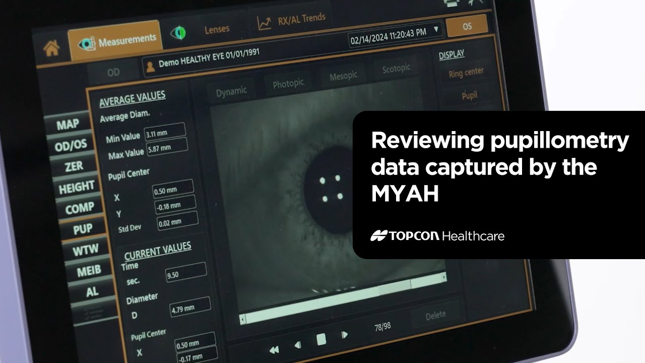 Reviewing pupillometry data captured with the Topcon MYAH
