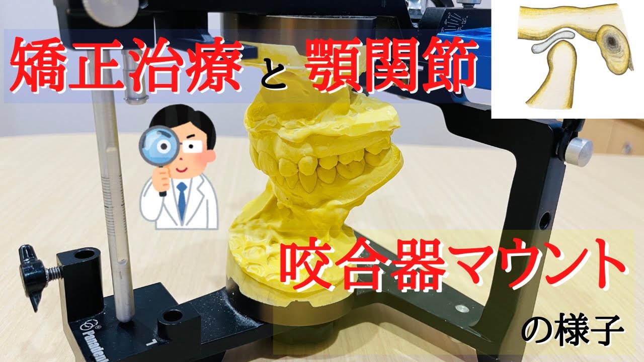【矯正】歯列矯正の咬合器マウント|顎関節と中心位