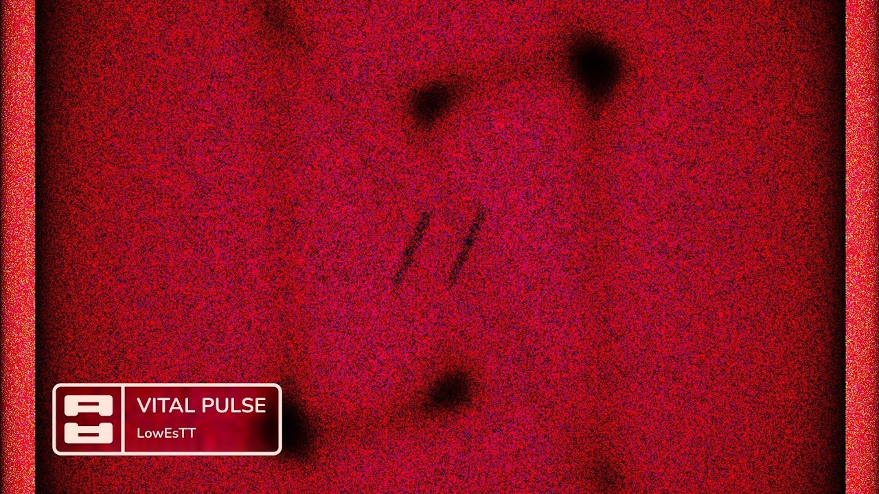 LowEsTT - VITAL PULSE [From 