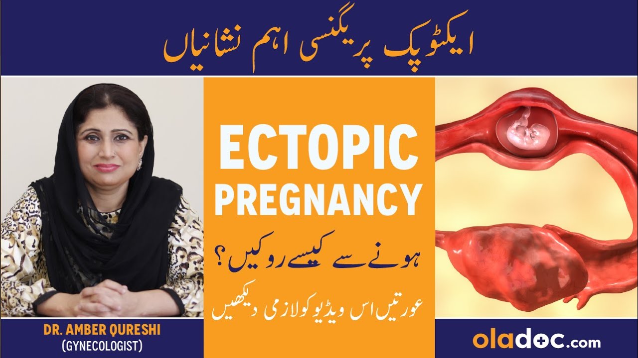 Ectopic Pregnancy Causes And Treatment - Ectopic Pregnancy Kya Hoti Hai -   Tube Men Hamal Ki Alamat